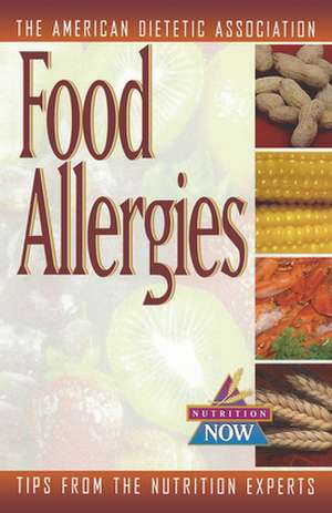 Food Allergies: The Nutrition Now Series de American Dietetic Association