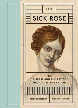 The Sick Rose de Richard Barnett