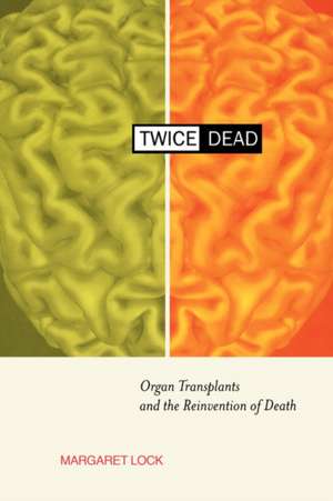 Twice Dead – Organ Transplants & the Reinvention of Death de Margaret Lock