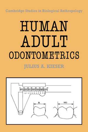 Human Adult Odontometrics: The Study of Variation in Adult Tooth Size de Julius A. Kieser