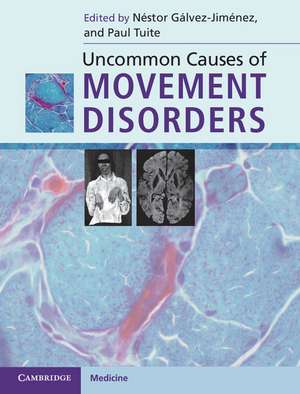 Uncommon Causes of Movement Disorders de Néstor Gálvez-Jiménez MD