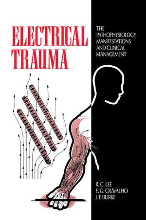 Electrical Trauma: The Pathophysiology, Manifestations and Clinical Management de R. C. Lee