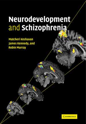 Neurodevelopment and Schizophrenia de Matcheri S. Keshavan