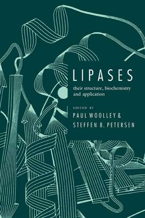 Lipases: Their Structure, Biochemistry and Application de Paul Woolley