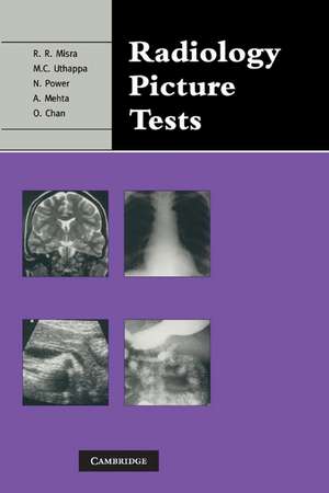 Radiology Picture Tests: Film Viewing and Interpretation for Part 1 FRCR de Rakesh R. Misra