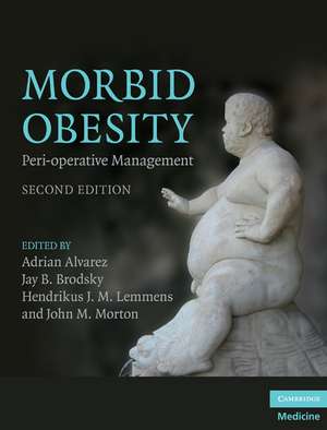 Morbid Obesity: Peri-operative Management de Adrian Alvarez