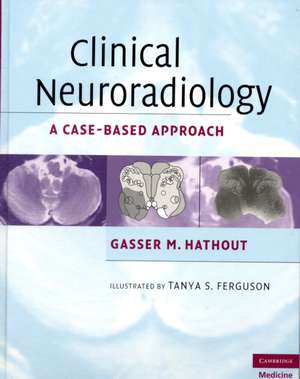 Clinical Neuroradiology: A Case-Based Approach de Gasser M. Hathout