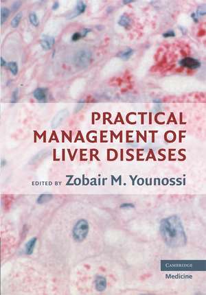 Practical Management of Liver Diseases de Zobair M. Younossi