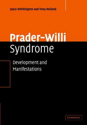 Prader-Willi Syndrome: Development and Manifestations de Joyce Whittington