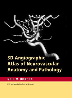 3D Angiographic Atlas of Neurovascular Anatomy and Pathology de Neil M. Borden MD