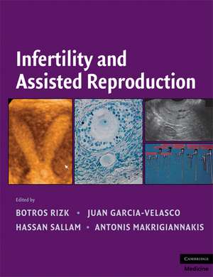 Infertility and Assisted Reproduction de Botros R. M. B. Rizk