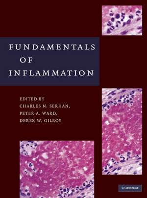 Fundamentals of Inflammation de Charles N. Serhan PhD