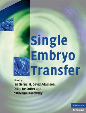 Single Embryo Transfer de Jan Gerris