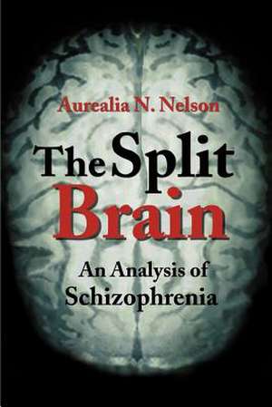 The Split Brain de Aurealia Nelson