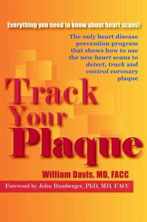 Track Your Plaque de William R. Davis