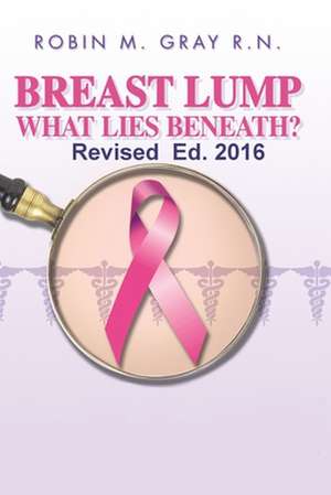 Breast Lump What Lies Beneath? de Robin M. Gray