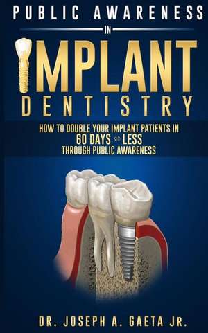 Public Awareness in Implant Dentistry: How to Double Your Implant Patients in 60 Days or Less Through Public Awareness de Dr Joseph a. Gaeta Jr