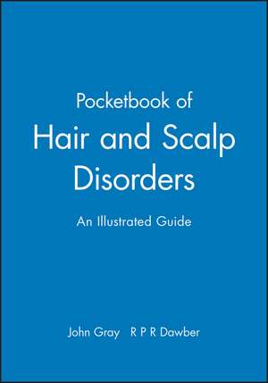 Pocketbook of Hair and Scalp Disorders de Gray