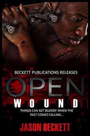 Open Wound 1