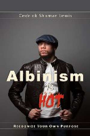 Albinism is Hot! de Cedrick Shamar Lewis