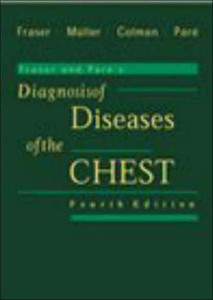 Fraser and Pare's Diagnosis of Diseases of the Chest: 4-Volume Set de Richard S. Fraser