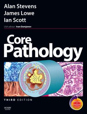 Core Pathology: with STUDENT CONSULT Online Access de Alan Stevens