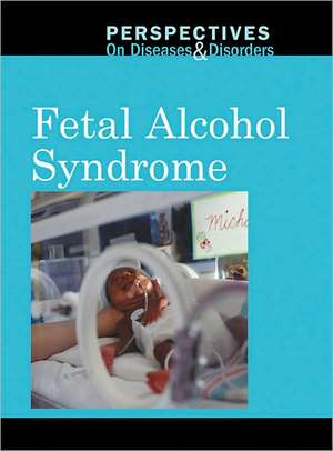 Fetal Alcohol Syndrome de Jacqueline Langwith