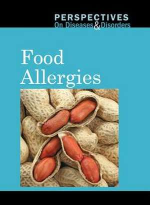 Food Allergies de Arthur Gillard