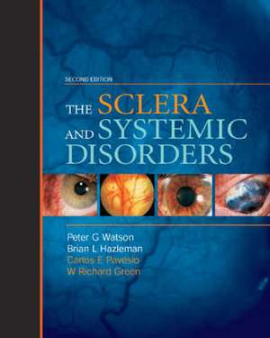 Sclera & Systemic Disorders de Peter Watson