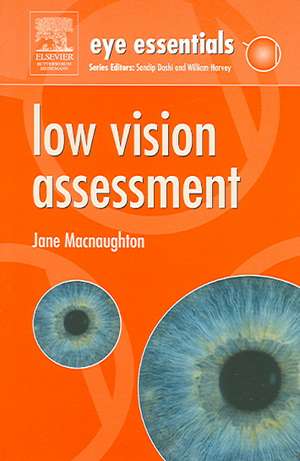 Eye Essentials: Low Vision Assessment de Jane Macnaughton