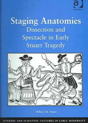 Staging Anatomies: Dissection and Spectacle in Early Stuart Tragedy de Hillary M. Nunn