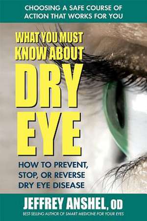 What You Must Know about Dry Eye de Anshel