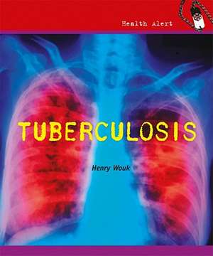 Tuberculosis de Henry Wouk