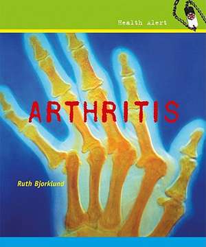 Arthritis de Ruth Bjorklund