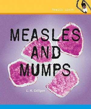 Measles and Mumps de L. H. Colligan