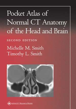 Pocket Atlas of Normal CT Anatomy of the Head and Brain