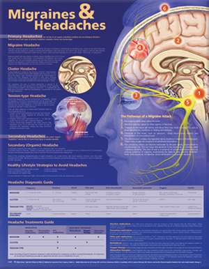 Migraines and Headaches Anatomical Chart de Anatomical Chart Company