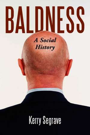 Baldness: A Social History de Kerry Segrave