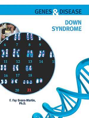 Down Syndrome de F. Fay Evans-Martin