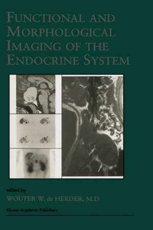 Functional and Morphological Imaging of the Endocrine System de W.W. de Herder