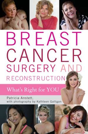 Breast Cancer Surgery and Reconstruction de Patricia Anstett