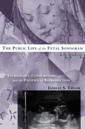 The Public Life of the Fetal Sonogram: Technology, Consumption, and the Politics of Reproduction de Janelle S. Taylor