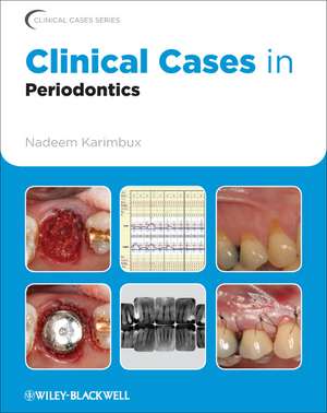 Clinical Cases in Periodontics de Nadeem Karimbux