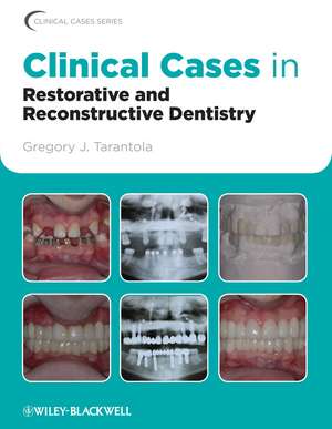 Clinical Cases in Restorative and Reconstructive Dentistry de GJ Tarantola