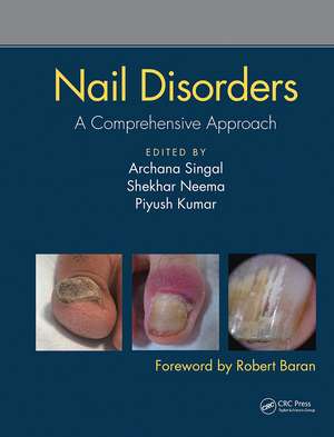 Nail Disorders: A Comprehensive Approach de Archana Singal