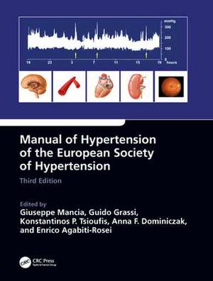 Manual of Hypertension of the European Society of Hypertension, Third Edition de Giuseppe Mancia