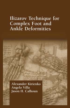 Ilizarov Technique for Complex Foot and Ankle Deformities de Alexander Kirienko