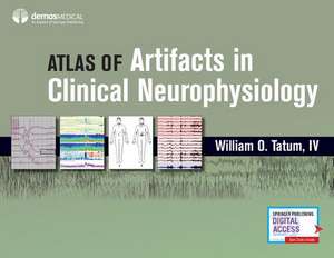 Atlas of Artifacts in Clinical Neurophysiology de William Tatum