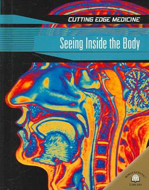 Seeing Inside the Body de Andrew Solway