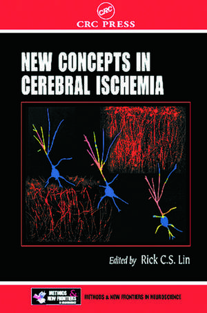 New Concepts in Cerebral Ischemia de Rick C. S. Lin